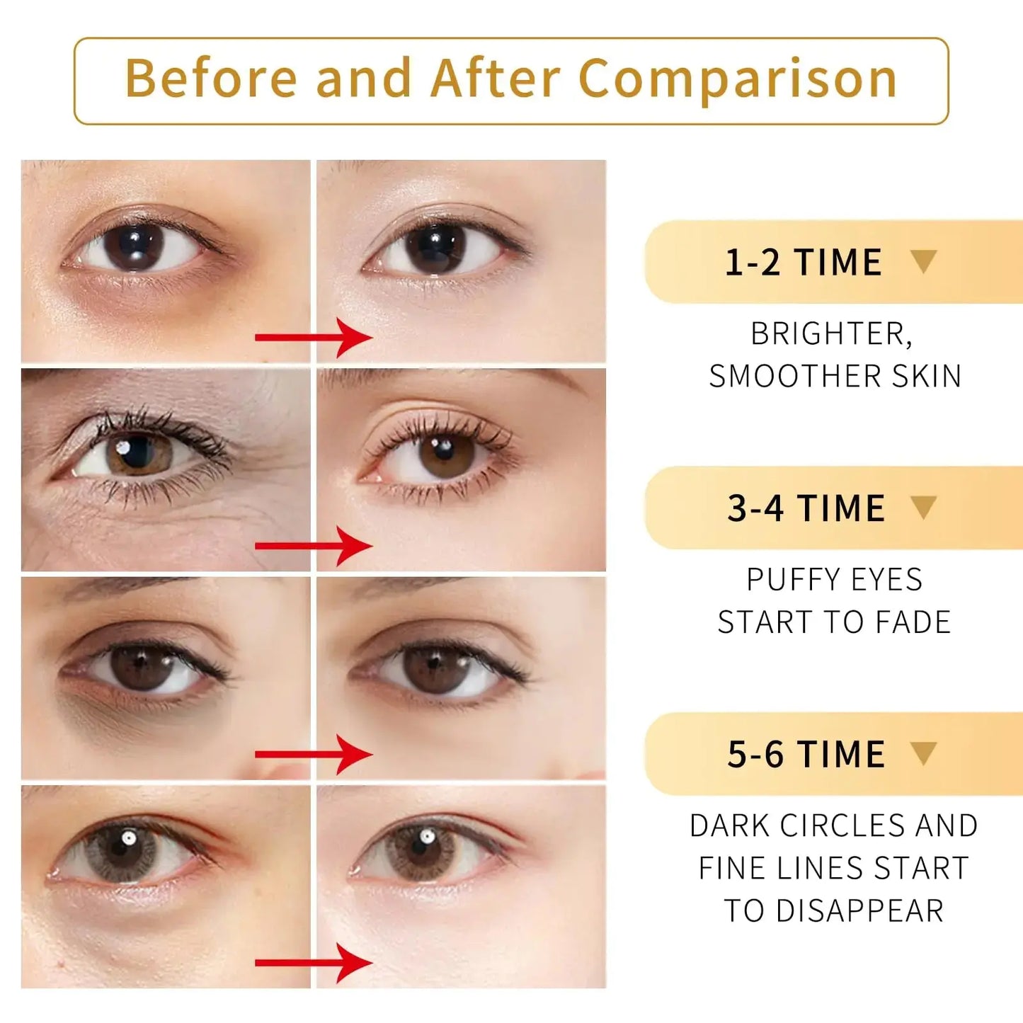 Tunbot Under Eye Patches - 60 Pieces - 24k Gold Eye Mask - Anti-Aging - Contains Collagen and Hyaluronic Acid - Removes Dark Circles, Puffiness and Wrinkles, Moisturizes - Home Beauty Chamomile My Store