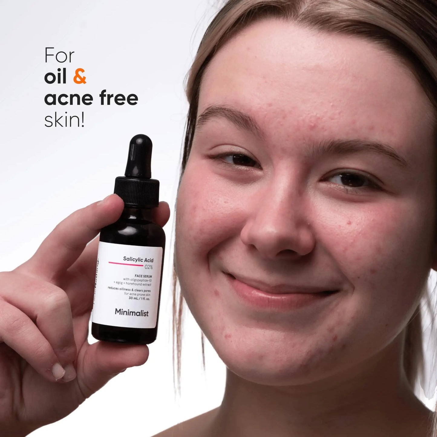 Minimalist 2% Salicylic Acid Serum For Acne, Blackhead & Open Pores | Reduces Excess Oil & Bumpy Texture | BHA Liquid Exfoliant for Acne Prone & Oily Skin | For Women & Men | 1 Fl Oz/30ml My Store