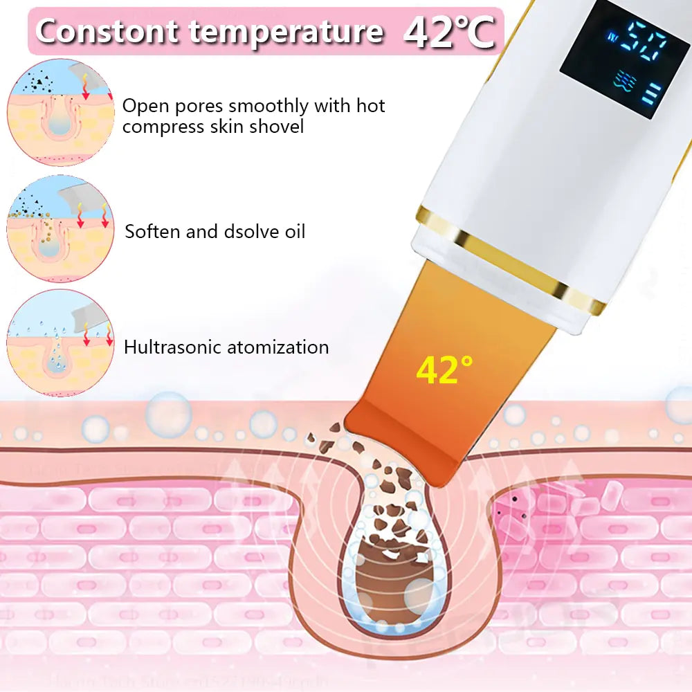 Ultrasonic Skin Scrubber: Facial Cleansing WEM Support (www.WEM.support)