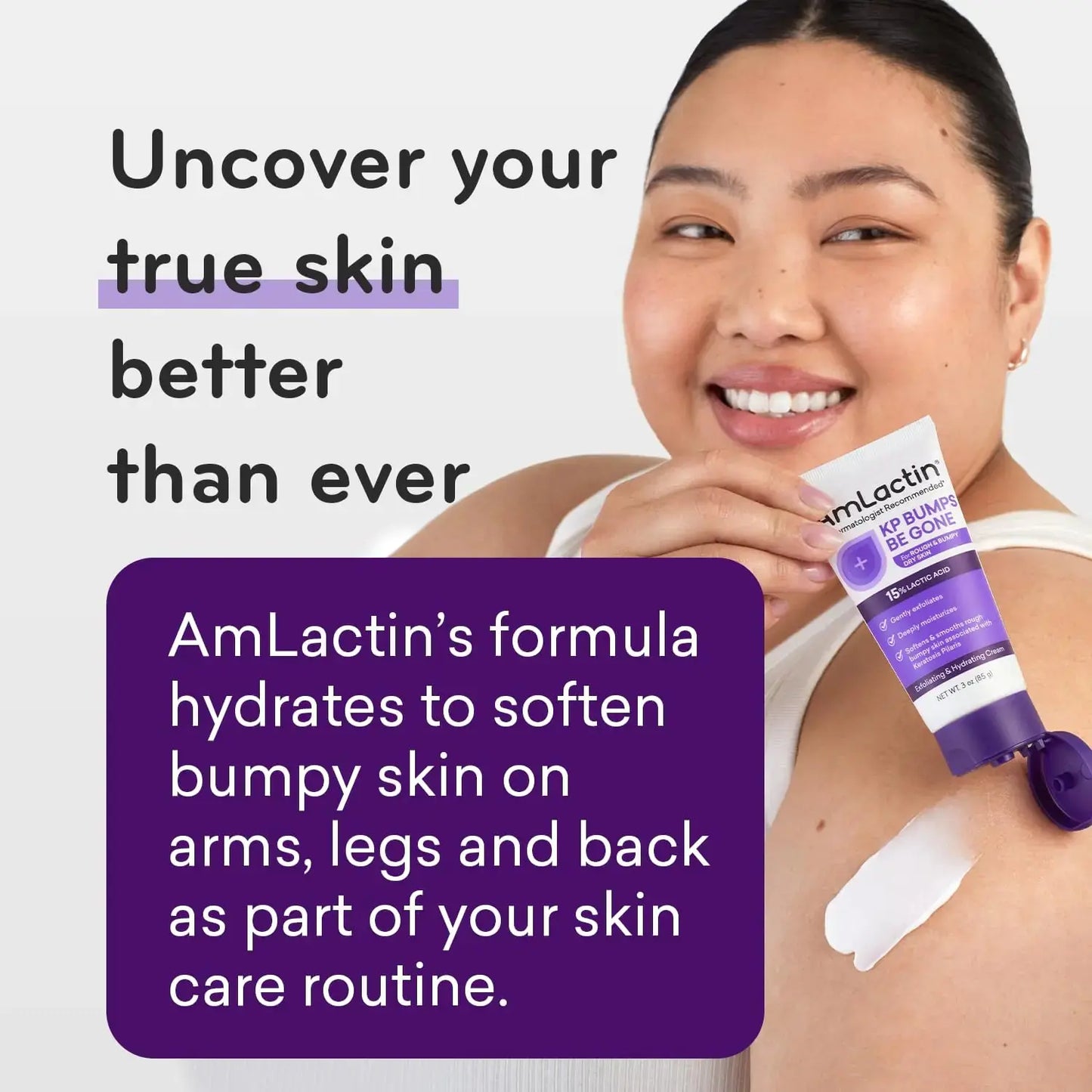 AmLactin KP Bumps Be Gone - 3 oz Keratosis Pilaris Moisturizing Cream with 15% Lactic Acid - Exfoliator and Moisturizer for Dry, Rough and Bumpy Skin, Pack of 2 (Packaging May Vary) 3 Ounce (Pack of 2) My Store