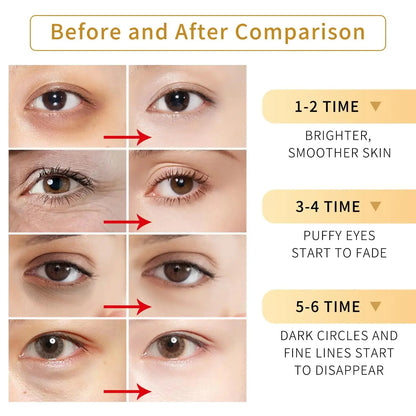 Tunbot Under Eye Patches - 60 Pieces - 24k Gold Eye Mask - Anti-Aging - Contains Collagen and Hyaluronic Acid - Removes Dark Circles, Puffiness and Wrinkles, Moisturizes - Home Beauty Chamomile My Store