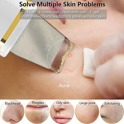 Ultrasonic Skin Scrubber: Facial Cleansing WEM Support (www.WEM.support)