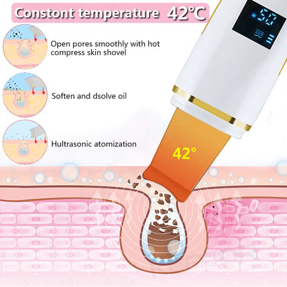 Ultrasonic Skin Scrubber: Facial Cleansing WEM Support (www.WEM.support)